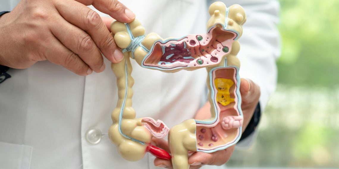 Intestine, appendix and digestive system, doctor holding anatomy model for study diagnosis.